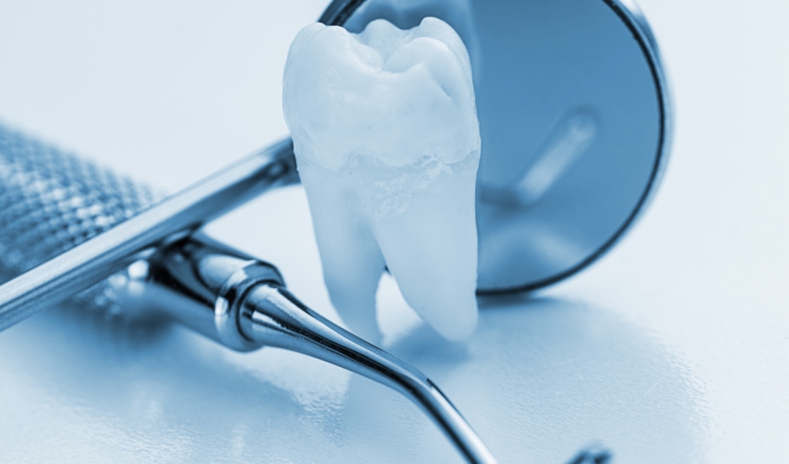 varastegan-Dental_Amalgam