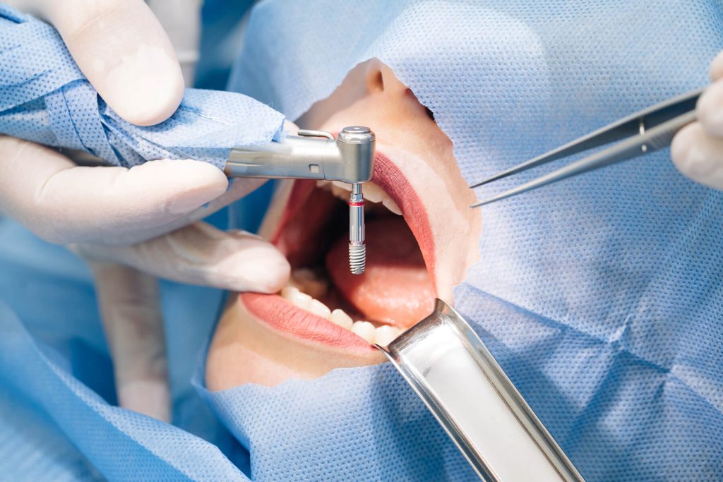 varastegan-dental-endodontics